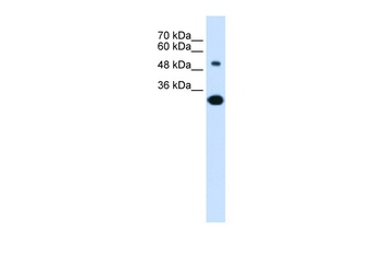 SLC2A5 Antibody