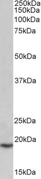 SLC40A1 Antibody
