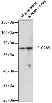 SLC2A5 Antibody