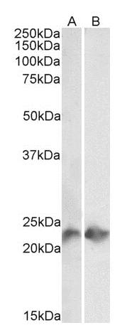 CD3 epsilon antibody