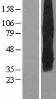 Glucose Transporter 5 GLUT5 (SLC2A5) Human Over-expression Lysate