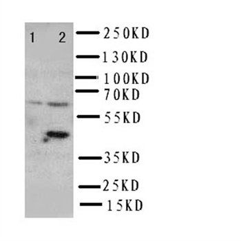 SLC22A6 Antibody