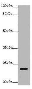 T-cell surface glycoprotein CD3 epsilon chain antibody
