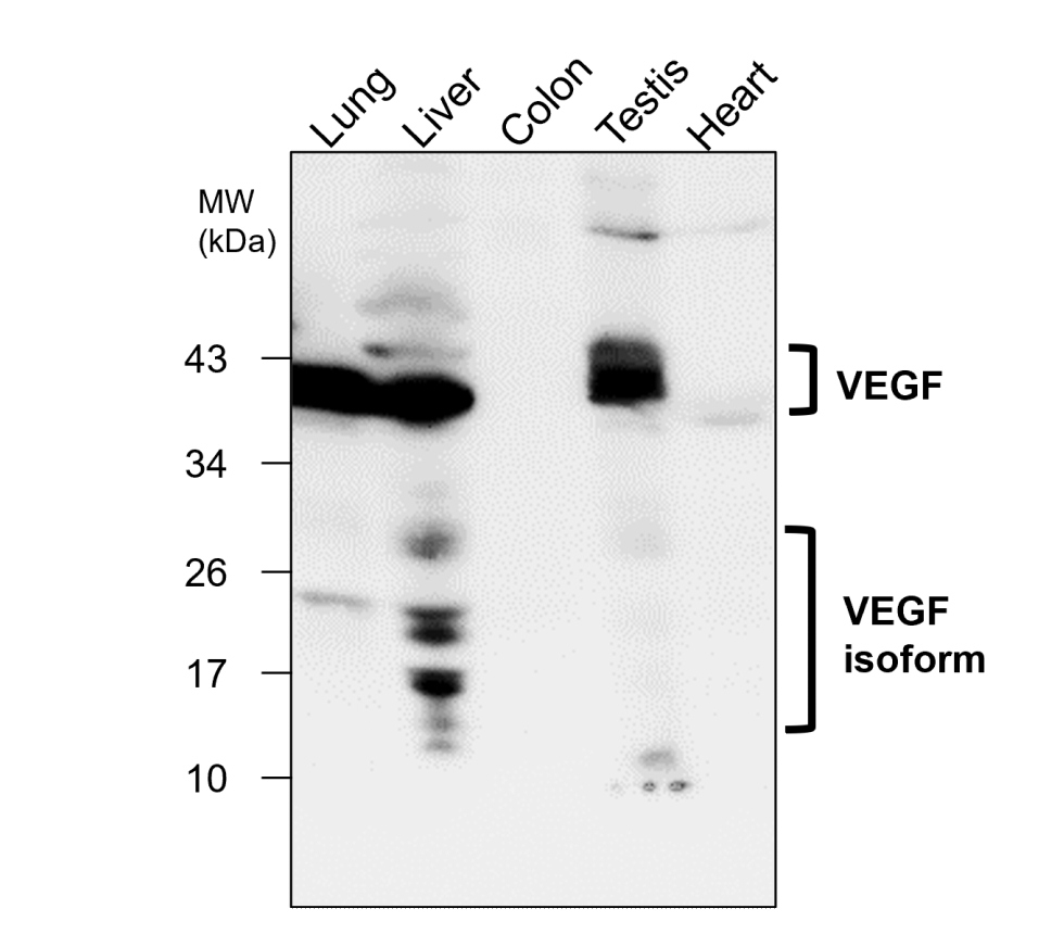 VEGF Antibody