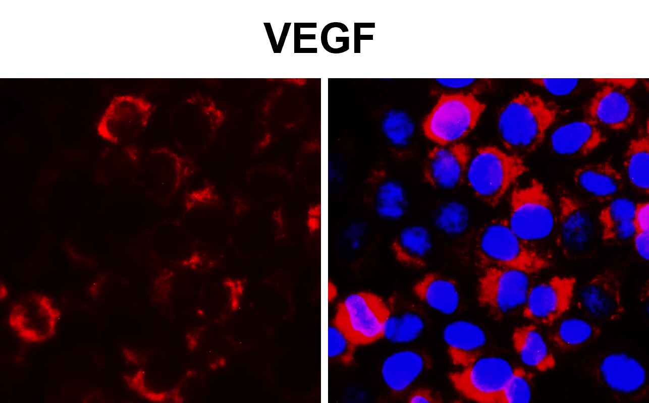 VEGF Antibody