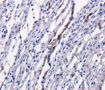 Tumor associated glycoprotein (TAG) 72 Antibody [B72.3 (Satumomab)], Mouse IgG1 - Research Grade Biosimilar