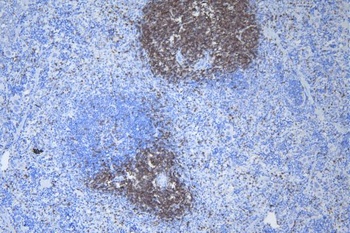 CD3 epsilon/Cd3e Antibody