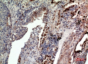 CD163b antibody