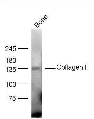 CO1A2 antibody