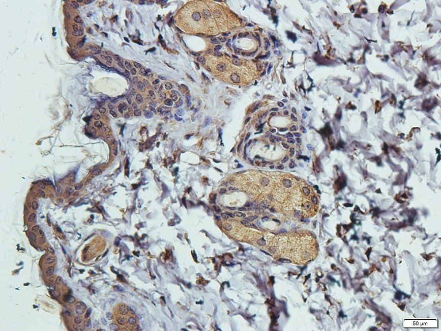 Slc28a3 antibody