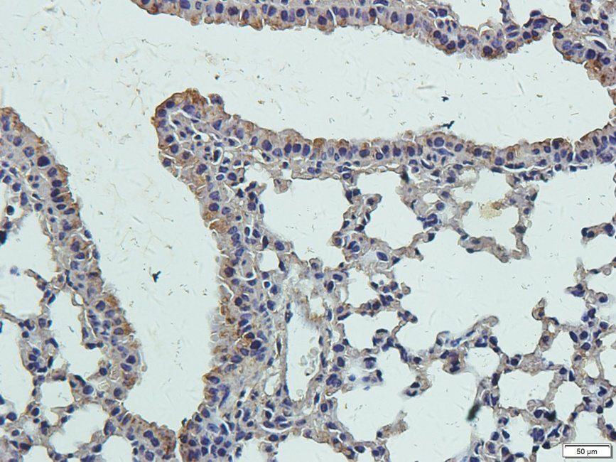 Slc28a3 antibody