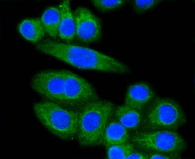 LDL Receptor Antibody