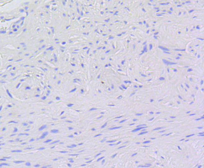 P-V-Myb+C-Myb(Phospho-S11) Antibody