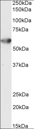 Goat anti-Desmin Antibody