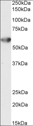 Desmin antibody