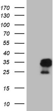 12 Lipoxygenase (ALOX12) antibody