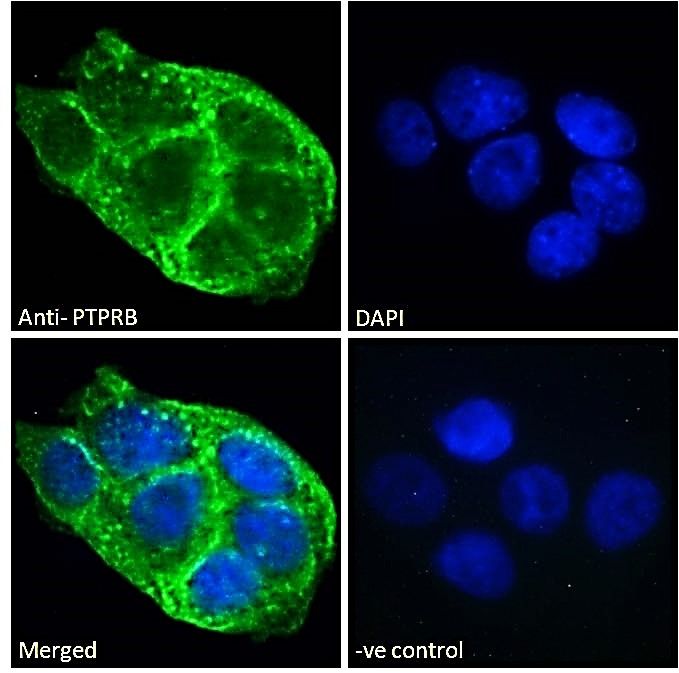 PTPRB antibody