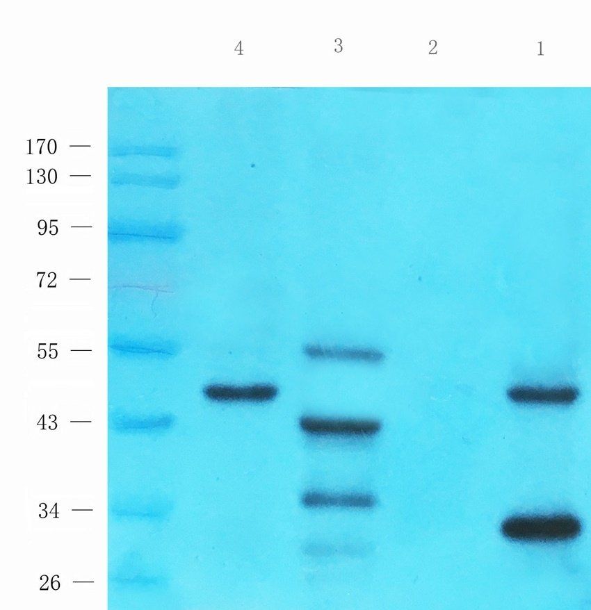 P2Y2 antibody