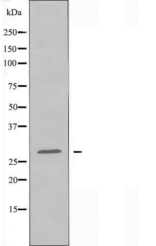 14-3-3 beta antibody