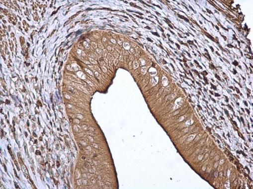 14-3-3 beta Rabbit Polyclonal Antibody