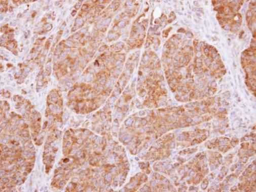 14-3-3 beta Rabbit Polyclonal Antibody