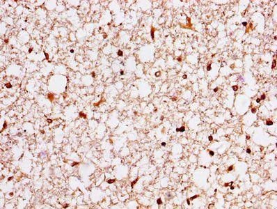 YWHAH Antibody