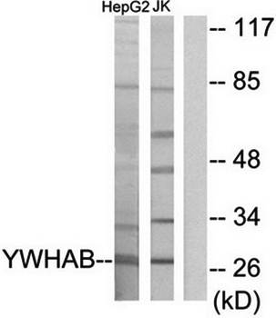 14-3-3 β Antibody