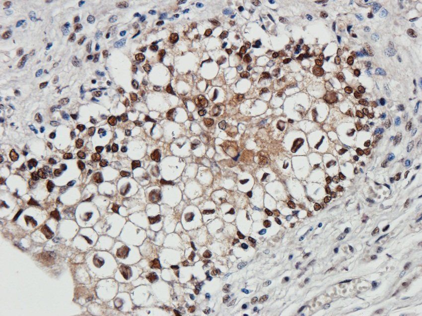 14-3-3 zeta/delta antibody