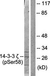 14-3-3 zeta (phospho-Ser58) antibody