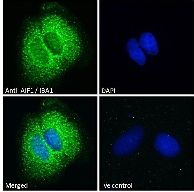 Interferon gamma antibody