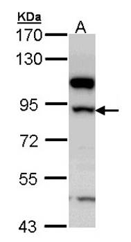 17beta-HSD4 antibody