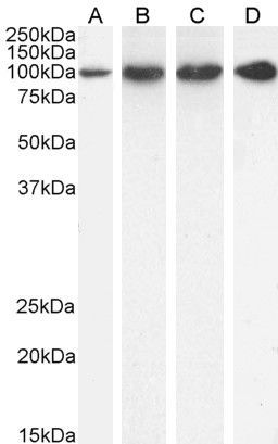 Goat anti-TRAP2 / Proteasome subunit 26S Antibody