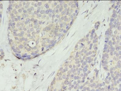 TMEM45A Antibody