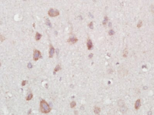 NARC1/PCSK9 Rabbit Polyclonal Antibody (FITC)