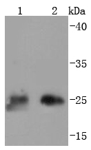 Thymidine Kinase 1 Antibody