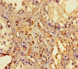 RNASEL Antibody