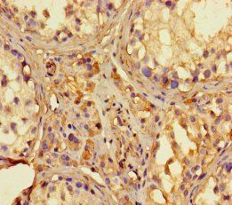 2-5A-dependent ribonuclease antibody