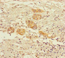 OGDH Antibody