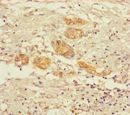 2-oxoglutarate dehydrogenase, mitochondrial antibody