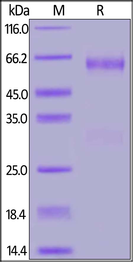 SARS-CoV-2 (COVID-19) Nucleocapsid Protein, His Tag