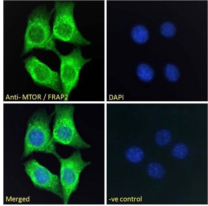Goat anti-MTOR / FRAP2 (aa1137-1150) Antibody