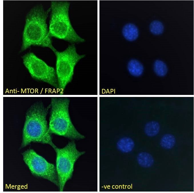 MTOR antibody