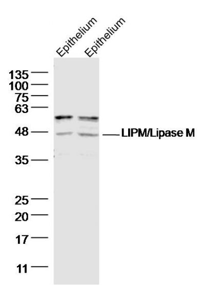 LIPM antibody
