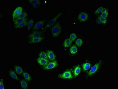 3-hydroxy-3 methylglutaryl-coenzyme A reductase antibody