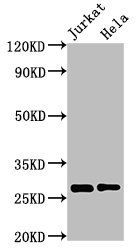 3-hydroxyacyl-CoA dehydrogenase type-2 antibody