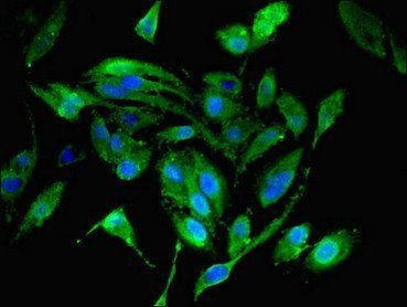 39S ribosomal protein L19, mitochondrial antibody