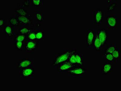 4-hydroxyphenylpyruvate dioxygenase antibody