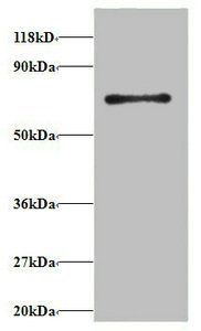 40S ribosomal protein S18 antibody