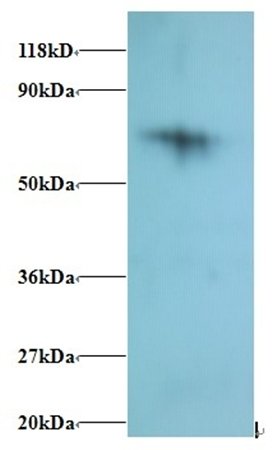 40S ribosomal protein S18 antibody (Biotin)