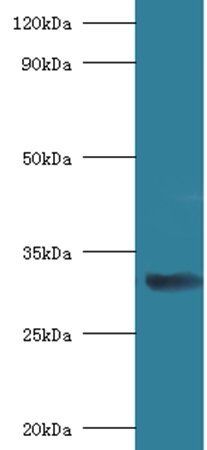40S ribosomal protein SA antibody